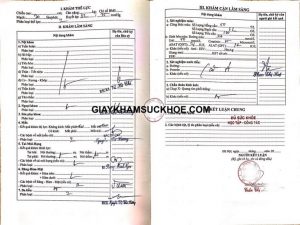 chi phí khám sức khỏe xin việc