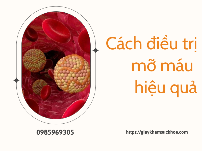 10 dấu hiệu mỡ máu cao và cách điều trị hiệu quả