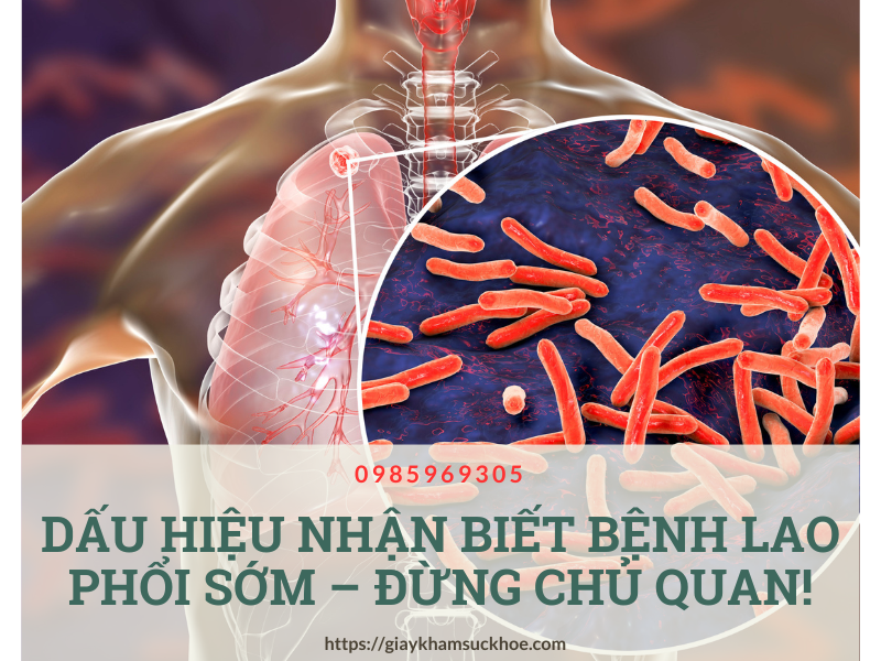 Dấu hiệu nhận biết bệnh lao phổi sớm – Đừng chủ quan!